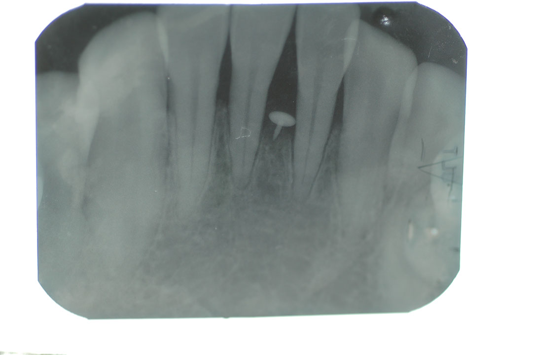 %_tempFileNamePerio%202t4%