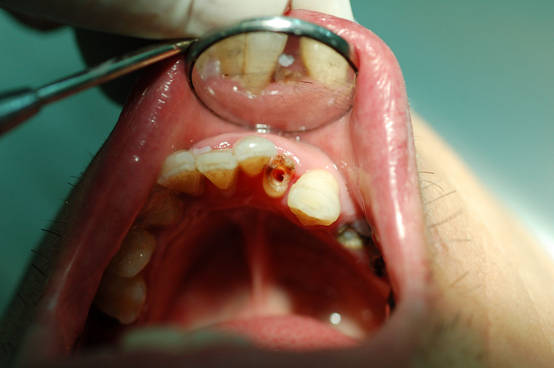 %_tempFileNamePost%202a%