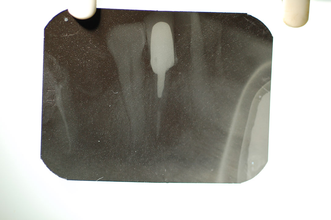 %_tempFileNamePost%202g%