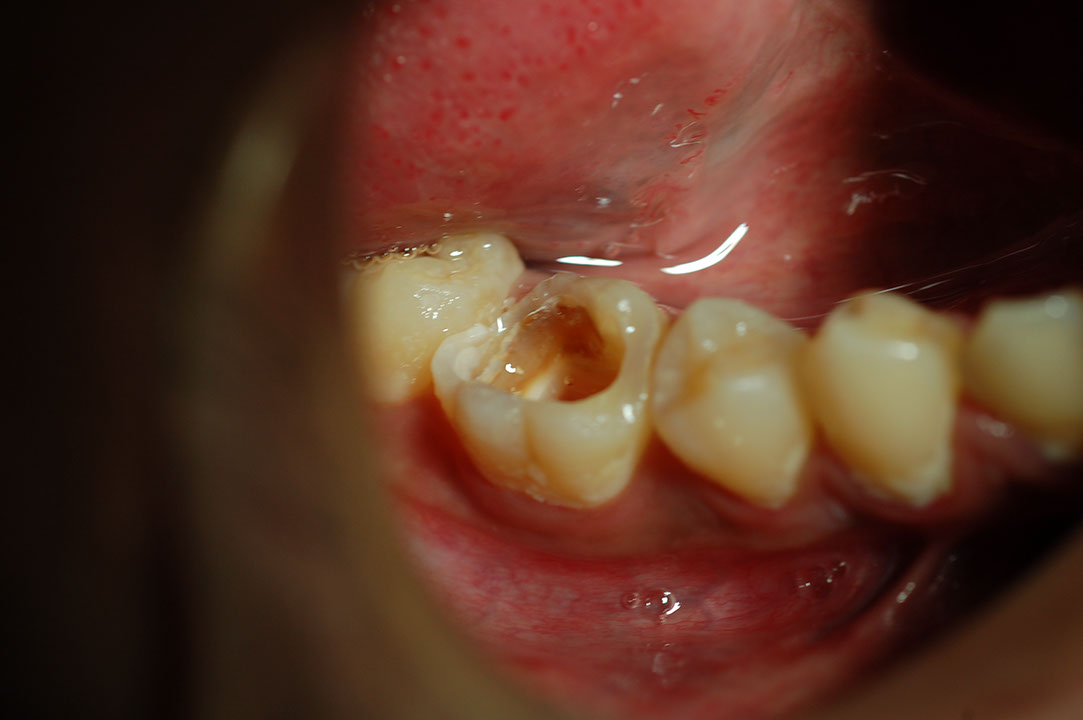 %_tempFileNamePost%205a%