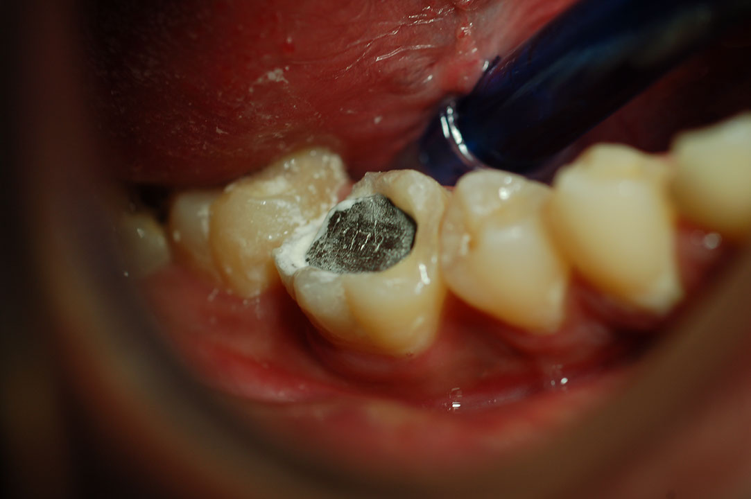 %_tempFileNamePost%205e%