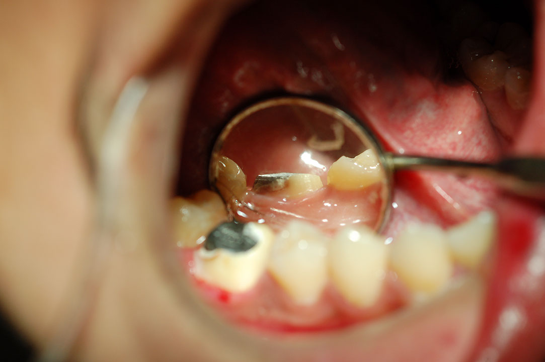 %_tempFileNamePost%205f1%