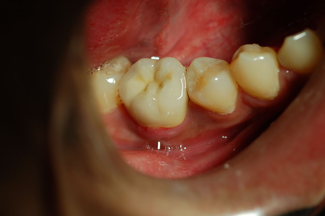 %_tempFileNamePost%205g2%