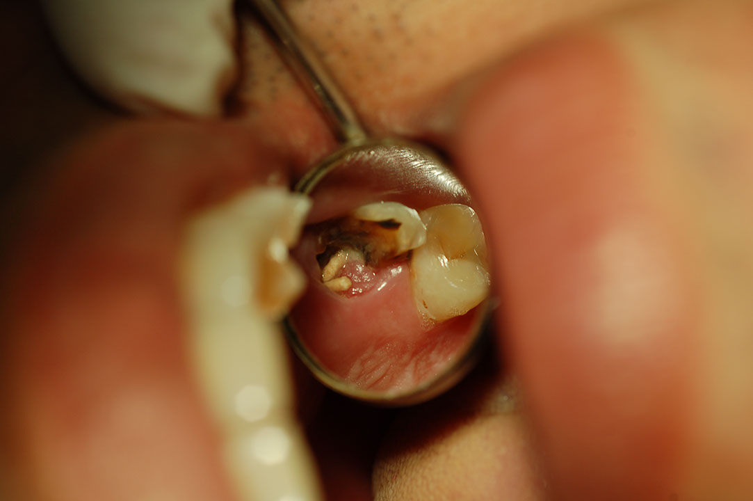 %_tempFileNamePost%205g3%