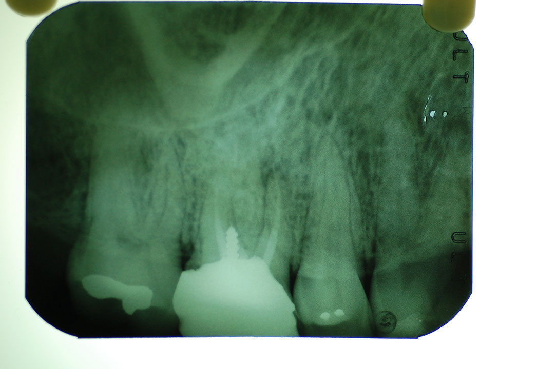 %_tempFileNamePost%205g7%