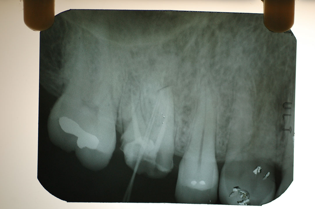 %_tempFileNamePost%205g9%