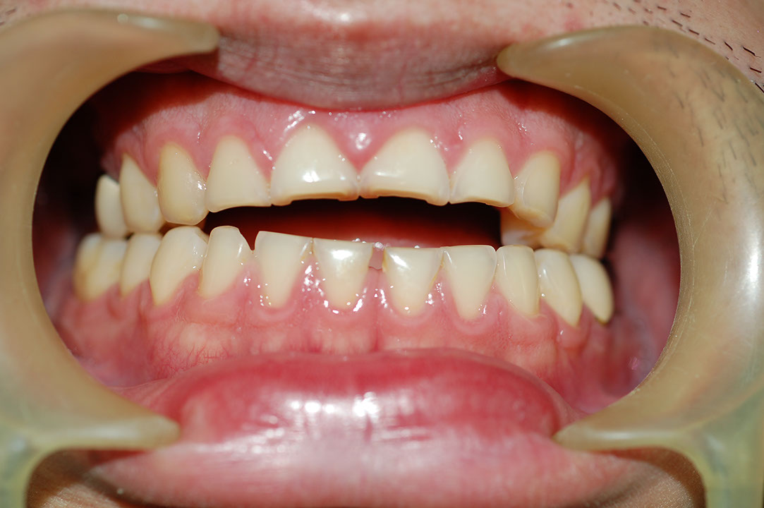 %_tempFileNamePost%206a%