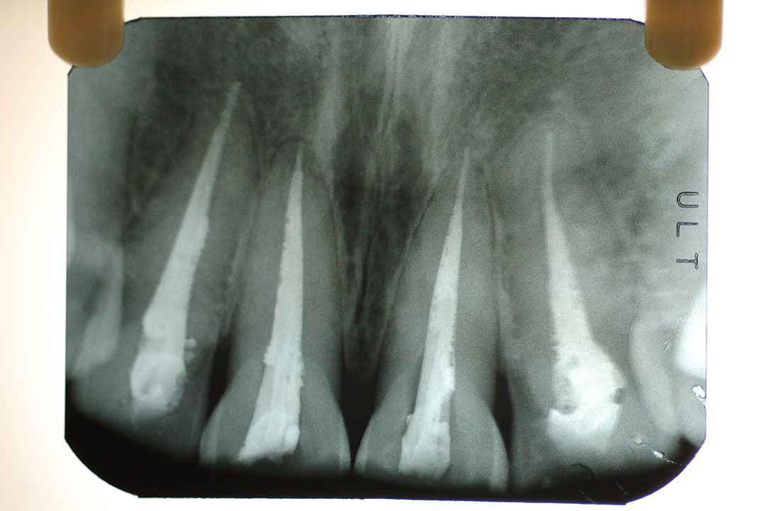 %_tempFileNamePost%206b%