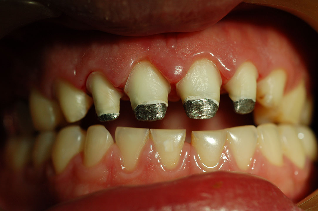 %_tempFileNamePost%206d%