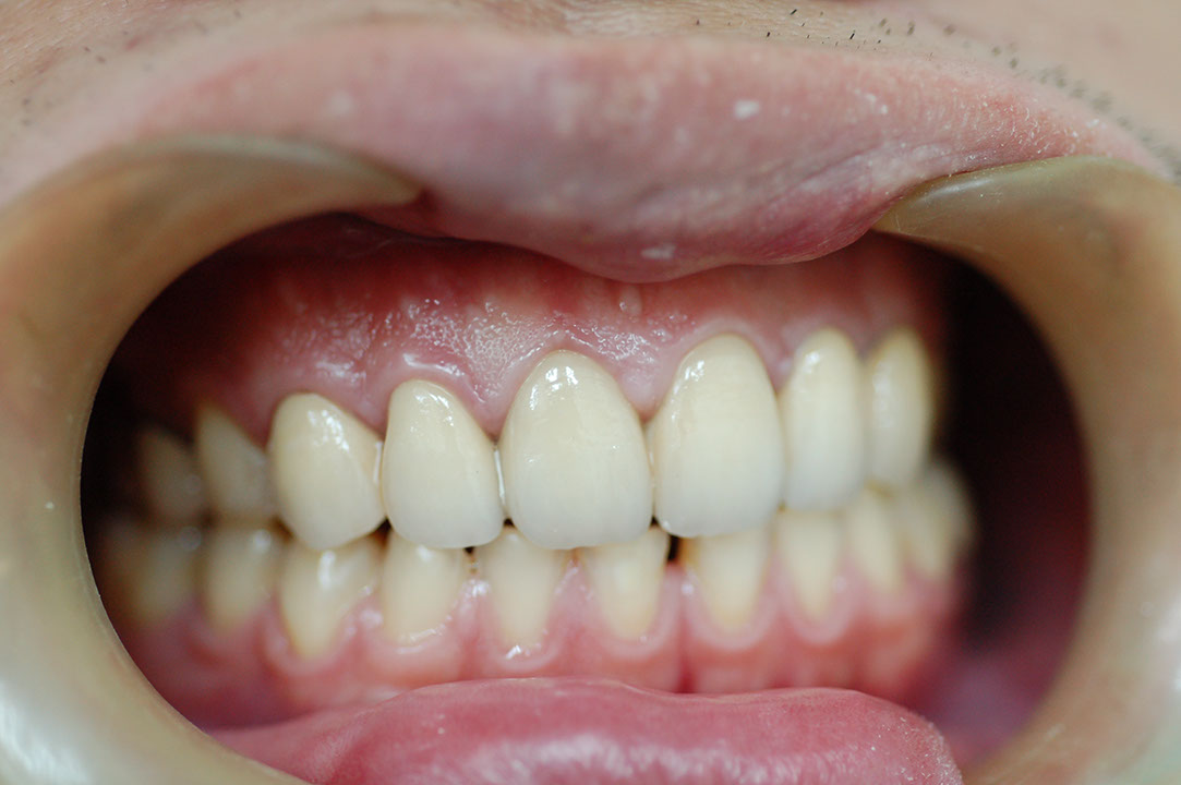 %_tempFileNamePost%206e%