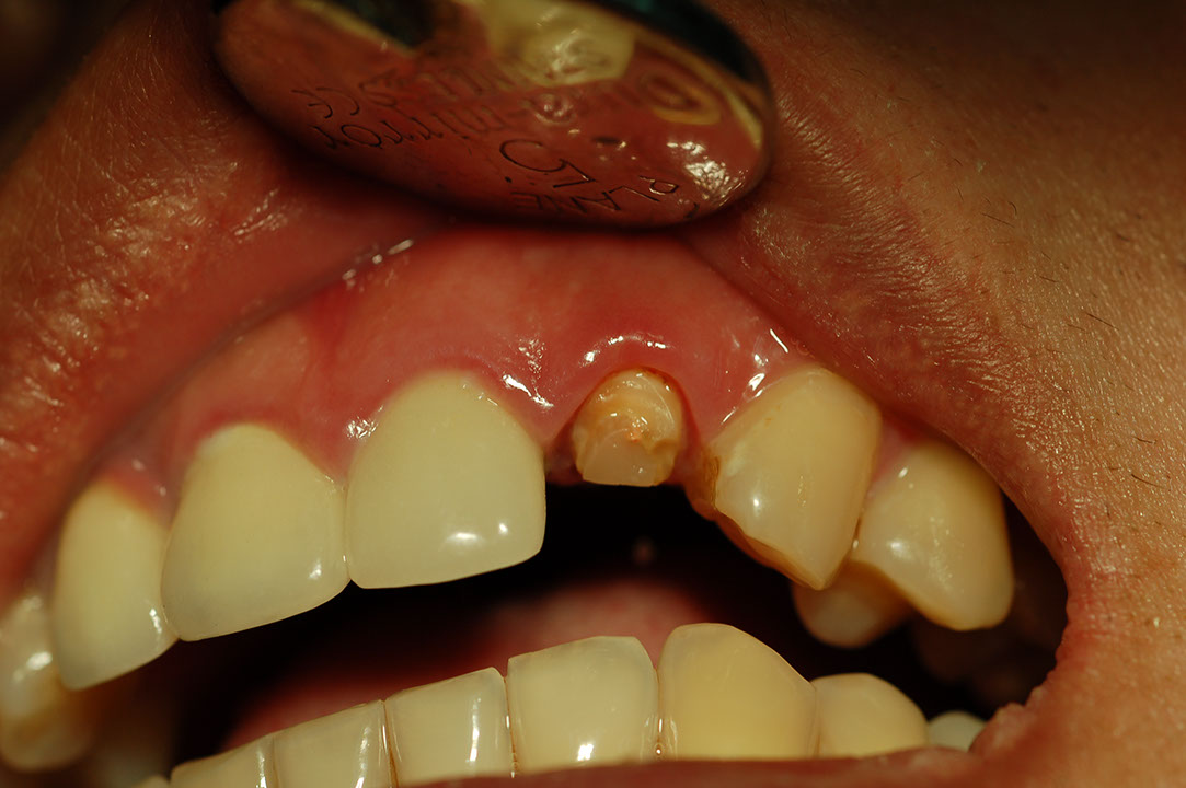 %_tempFileNamePost%207c%