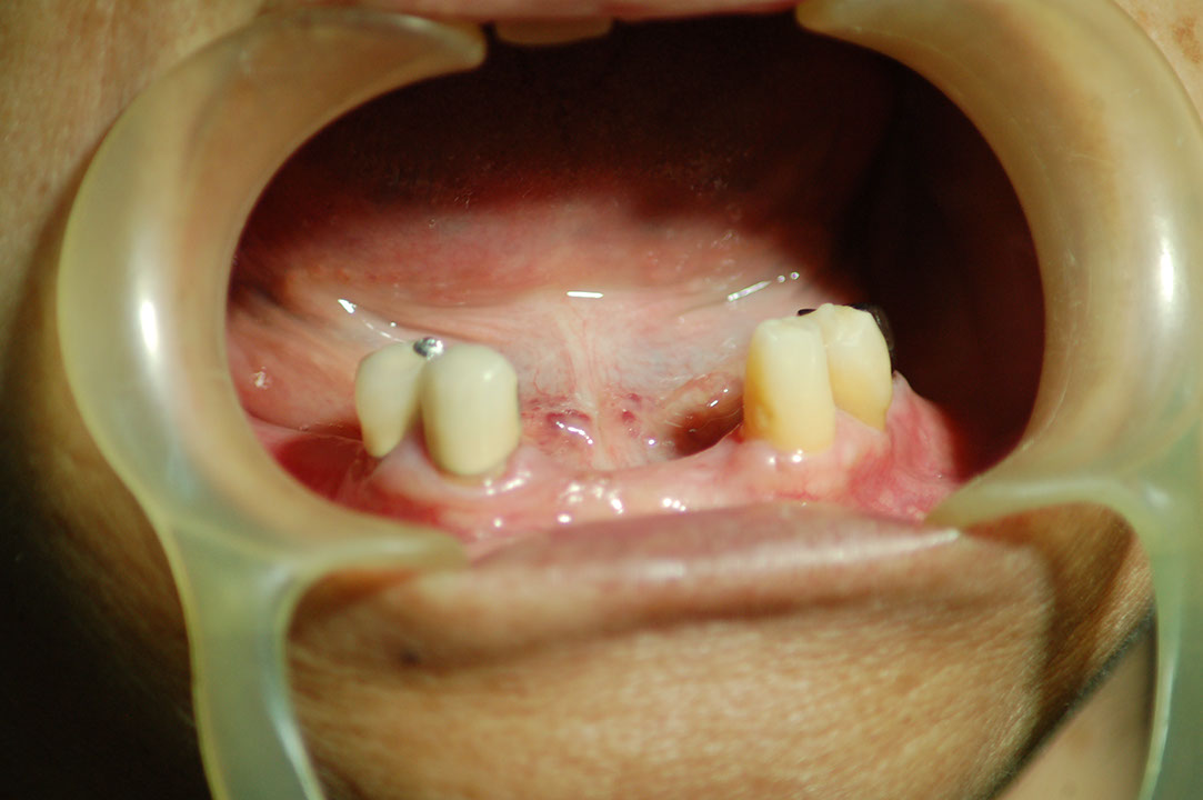 %_tempFileNameRPD%201a%