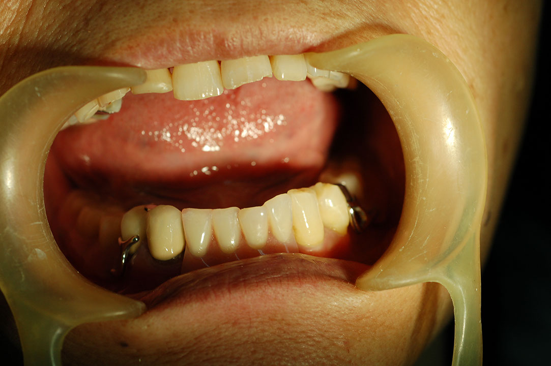 %_tempFileNameRPD%201c%