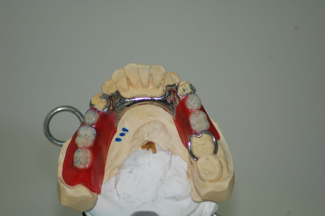 %_tempFileNameRPD%203a%