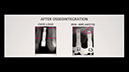 %_tempFileName13AAP-FCE14_Peri-Implantitis%5B21-15-13%5D%