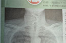 %_tempFileNameDSC_0095%
