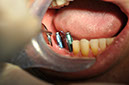 %_tempFileNameIMplant%2040c5%