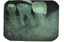 %_tempFileNameImplant%20104a1%