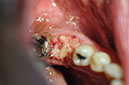 %_tempFileNameImplant%20104a5%