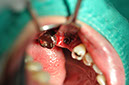 %_tempFileNameImplant%20104b1%