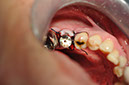 %_tempFileNameImplant%20104b7%