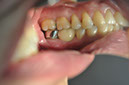 %_tempFileNameImplant%20104c4%