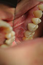 %_tempFileNameImplant%20105c1%
