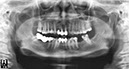 %_tempFileNameImplant%20107a1%