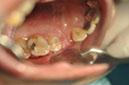 %_tempFileNameImplant%20107b8%