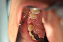 %_tempFileNameImplant%20107d1%