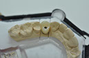 %_tempFileNameImplant%20107d5%