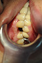 %_tempFileNameImplant%20107d6%