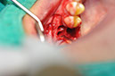 %_tempFileNameImplant%20108a3%