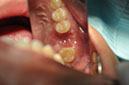 %_tempFileNameImplant%20108b4%