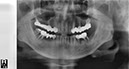 %_tempFileNameImplant%20109a2%