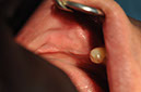 %_tempFileNameImplant%20109c3%