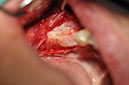 %_tempFileNameImplant%20109d4%