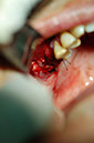 %_tempFileNameImplant%2010c1%