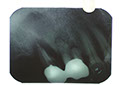 %_tempFileNameImplant%2010e1%