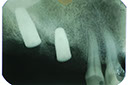 %_tempFileNameImplant%2010e6%