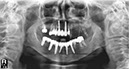 %_tempFileNameImplant%20111d3%