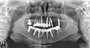 %_tempFileNameImplant%20111d4%