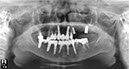 %_tempFileNameImplant%20111d5%