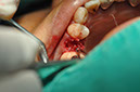 %_tempFileNameImplant%20113a5%