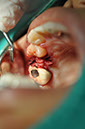 %_tempFileNameImplant%20113a7%