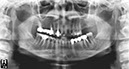 %_tempFileNameImplant%20115Ea2%