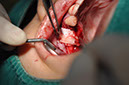 %_tempFileNameImplant%20115Ec1%