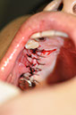%_tempFileNameImplant%20115Ec2%