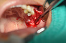 %_tempFileNameImplant%20115a2%