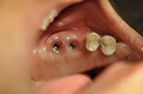 %_tempFileNameImplant%20115b8%